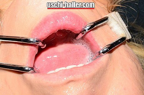 Farah bitch takes cumshots in her mouth while affixed with a mouth spreader - Image 3 of 15  in Pussy category   featuring Berichte, Farah Slut 