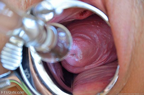 Young teen babe Roxy fists her clam before playing with a vagina stretcher - Image 18 of 20  in Big Clit category   featuring Roxy Raye 