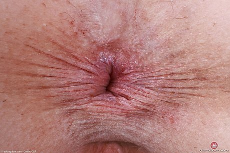 ATK Exotics Hot Pictures - Image 21 of 21  in Big Clit category   featuring Stella Nash 